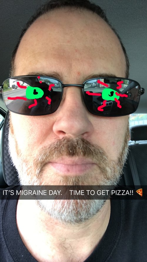 migraine